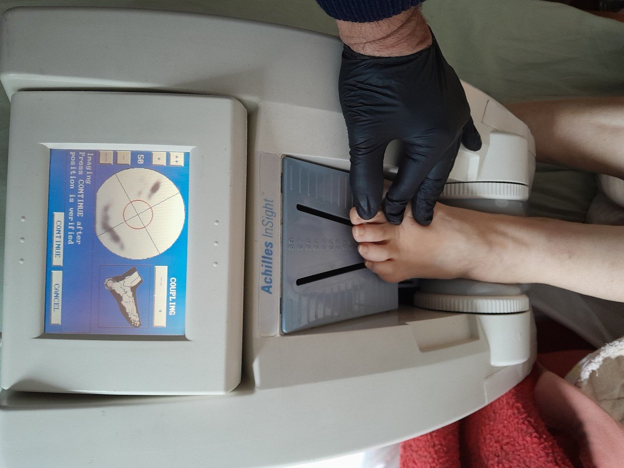 Μέτρηση οστικής πυκνότητας - 1151