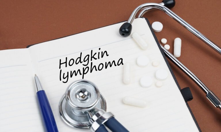Read more about the article Λέμφωμα Hodgkin: Χαμόγελα για τις τελευταίες εξελίξεις στη θεραπεία