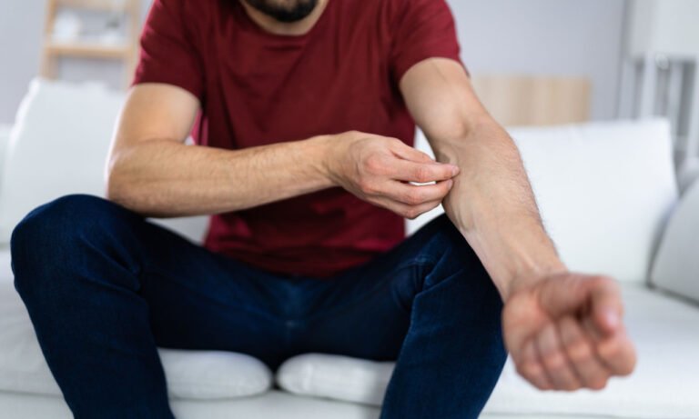 Read more about the article Φαγούρα σε όλο το σώμα: Όλες οι πιθανές αιτίες – Πότε είναι σοβαρό