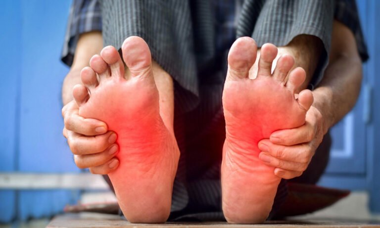 Read more about the article Γιατί καίνε τα πόδια σας: 9 λύσεις ανακούφισης – Πότε είναι σοβαρό
