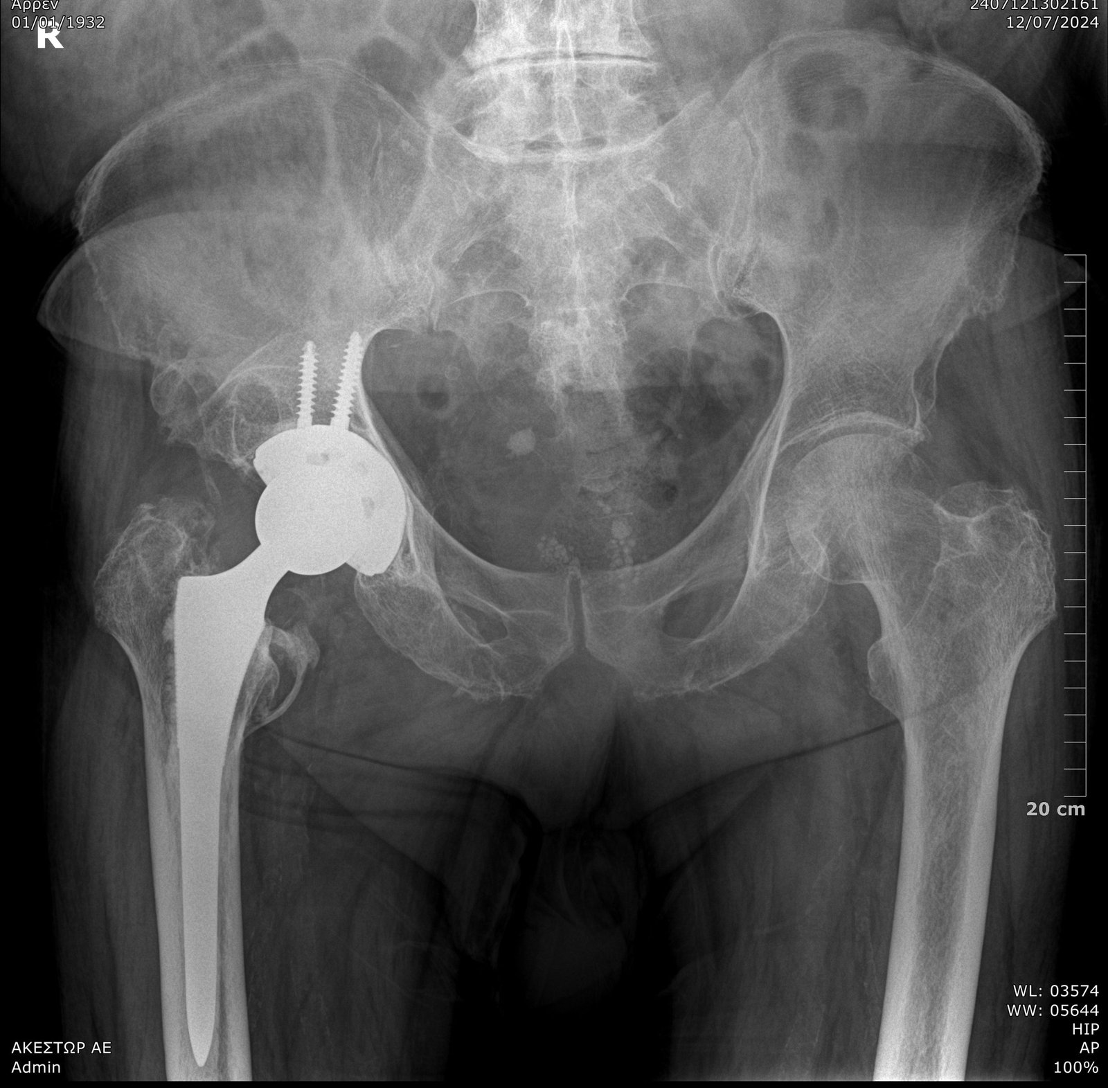 ακτινογραφία κατ οίκον