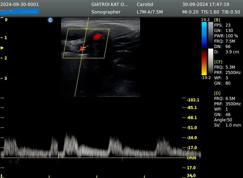 τρίπλεξ καρωτίδων κατ΄ οίκον