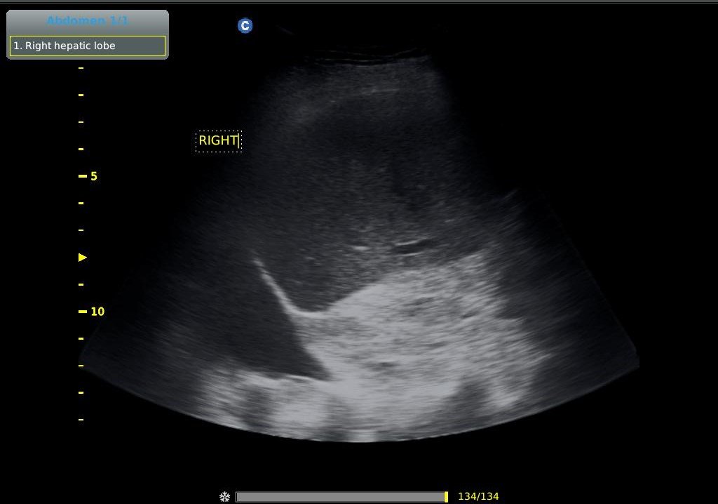 υπέρηχος άνω κάτω κοιλίας κατ' οίκον