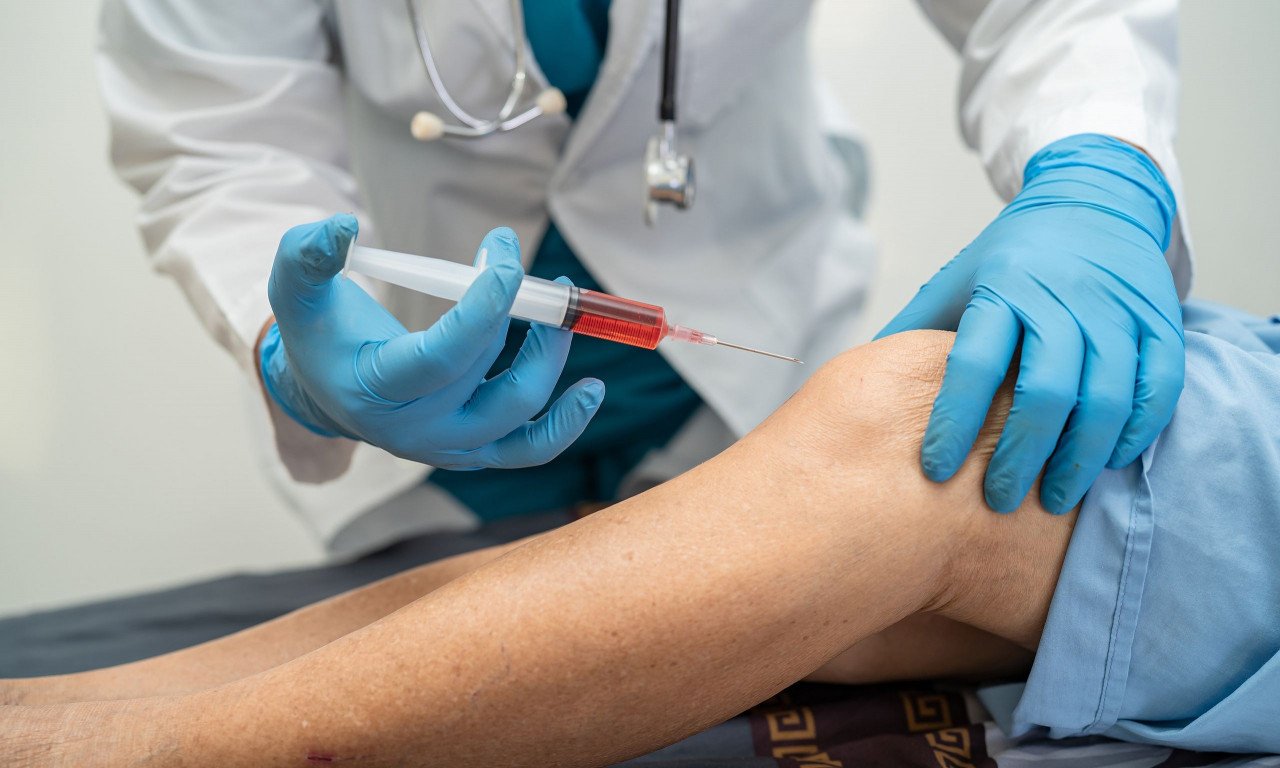 You are currently viewing Υαλουρονικό οξύ: Χρήσεις, αλληλεπίδραση με φάρμακα, ασφάλεια