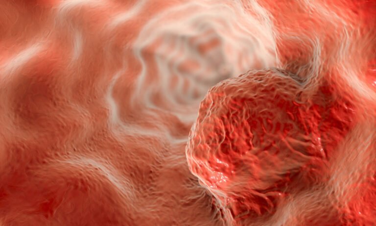 Read more about the article Πώς εκδηλώνεται ο καρκίνος του οισοφάγου: Τα πρώτα συμπτώματα που πρέπει να προσέξετε