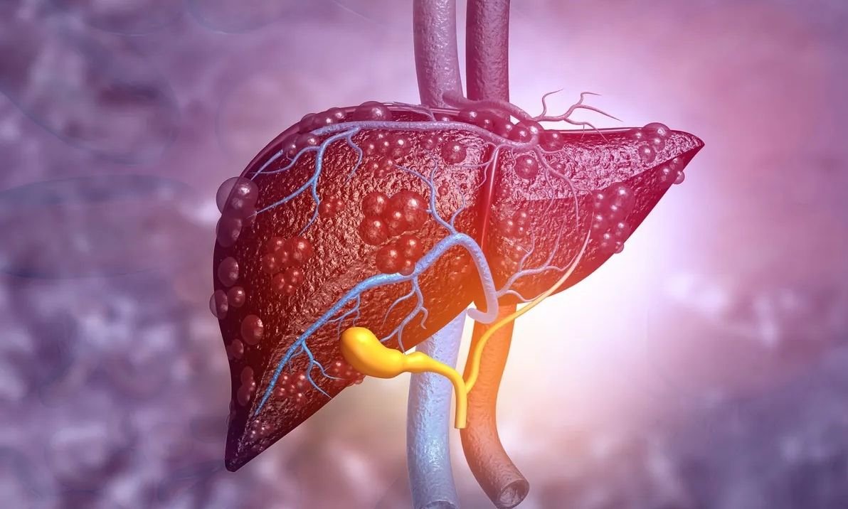 You are currently viewing Οι τροφές που μειώνουν την περιεκτικότητα του ήπατος σε λίπος