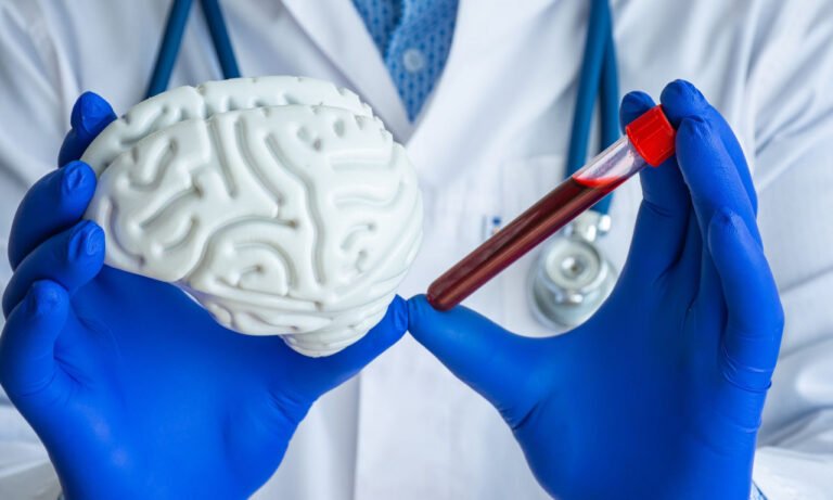 Read more about the article Τι προκαλούν στον εγκέφαλο οι αυξομειώσεις της χοληστερίνης