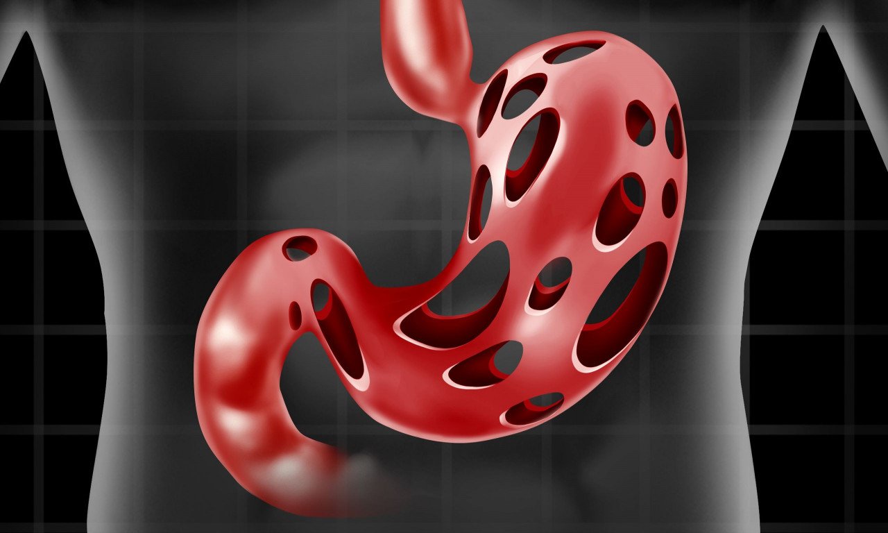 You are currently viewing Πώς θα καθαρίσετε το στομάχι σας: Επτά σπιτικές θεραπείες για να το διατηρήσετε υγιές