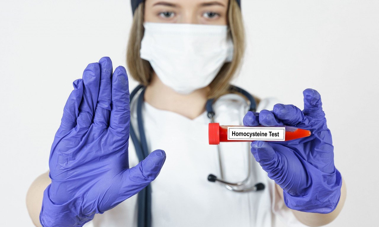 You are currently viewing Πώς μειώνεται φυσικά η ομοκυστεΐνη και τι σημασία έχει για την υγεία σας