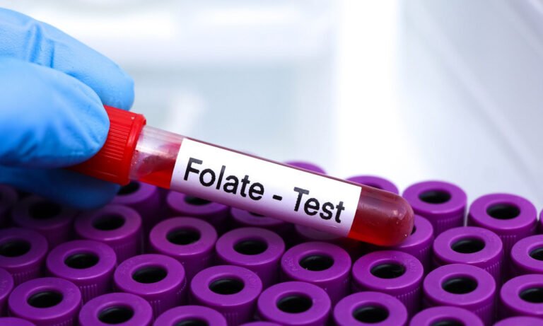 Read more about the article Χαμηλό φυλλικό οξύ: Τι προκαλεί και πώς αντιμετωπίζεται