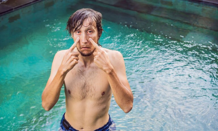 Read more about the article Πώς βγαίνει το χλώριο της πισίνας από τα μάτια για να μην καίνε