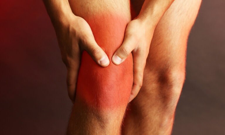 Read more about the article Αρθρίτιδα γόνατος: Οι πιο φθηνοί & αποτελεσματικοί τρόποι για τον πόνο και τη βελτίωση της κίνησης
