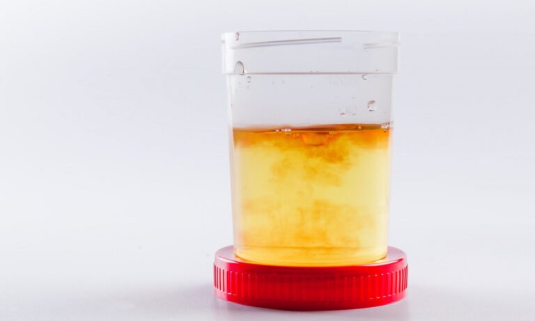 Read more about the article Θολά ούρα: Είναι ένδειξη ότι τρώτε πολλές πρωτεΐνες;