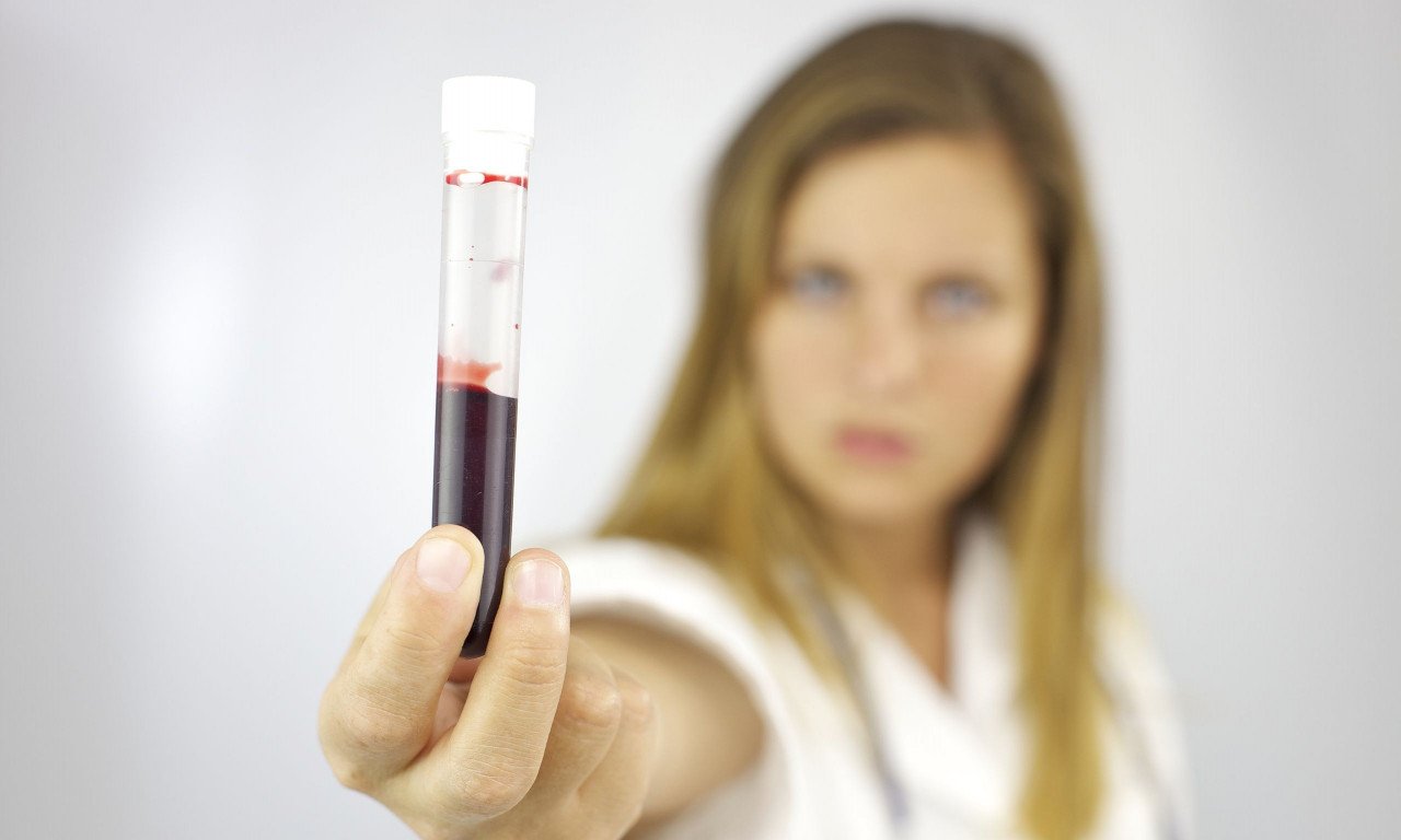 You are currently viewing Ποιοι είναι οι βιοδείκτες καρκίνου παχέος εντέρου και γιατί είναι σημαντικοί;