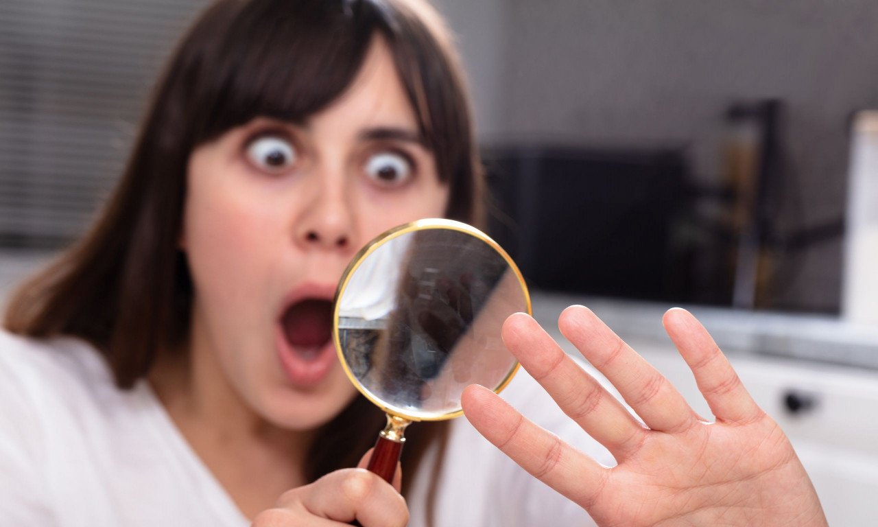 You are currently viewing Γυροειδής αλωπεκία: 6 σημάδια στα νύχια που δείχνουν σοβαρό πρόβλημα