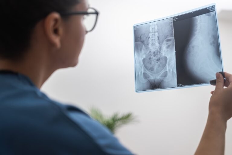 Read more about the article Ακτινογραφία στο σπίτι: Όλα όσα θέλετε να ξέρετε
