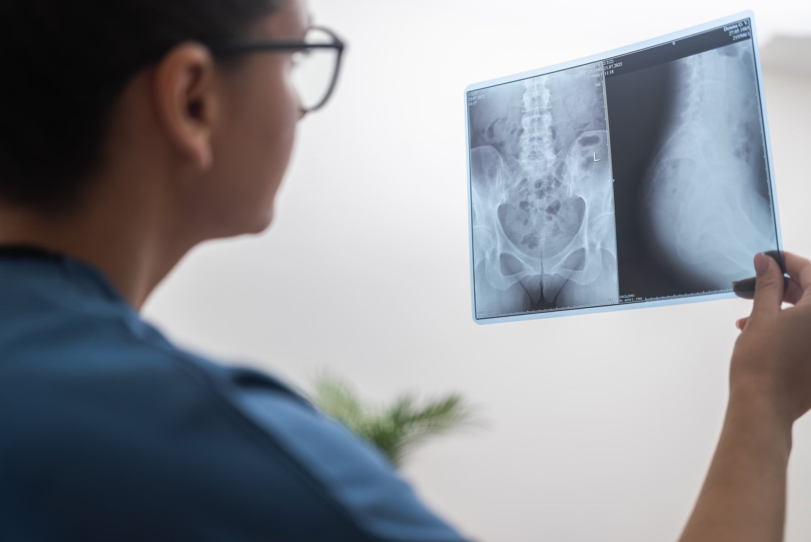 You are currently viewing Ακτινογραφία στο σπίτι: Όλα όσα θέλετε να ξέρετε