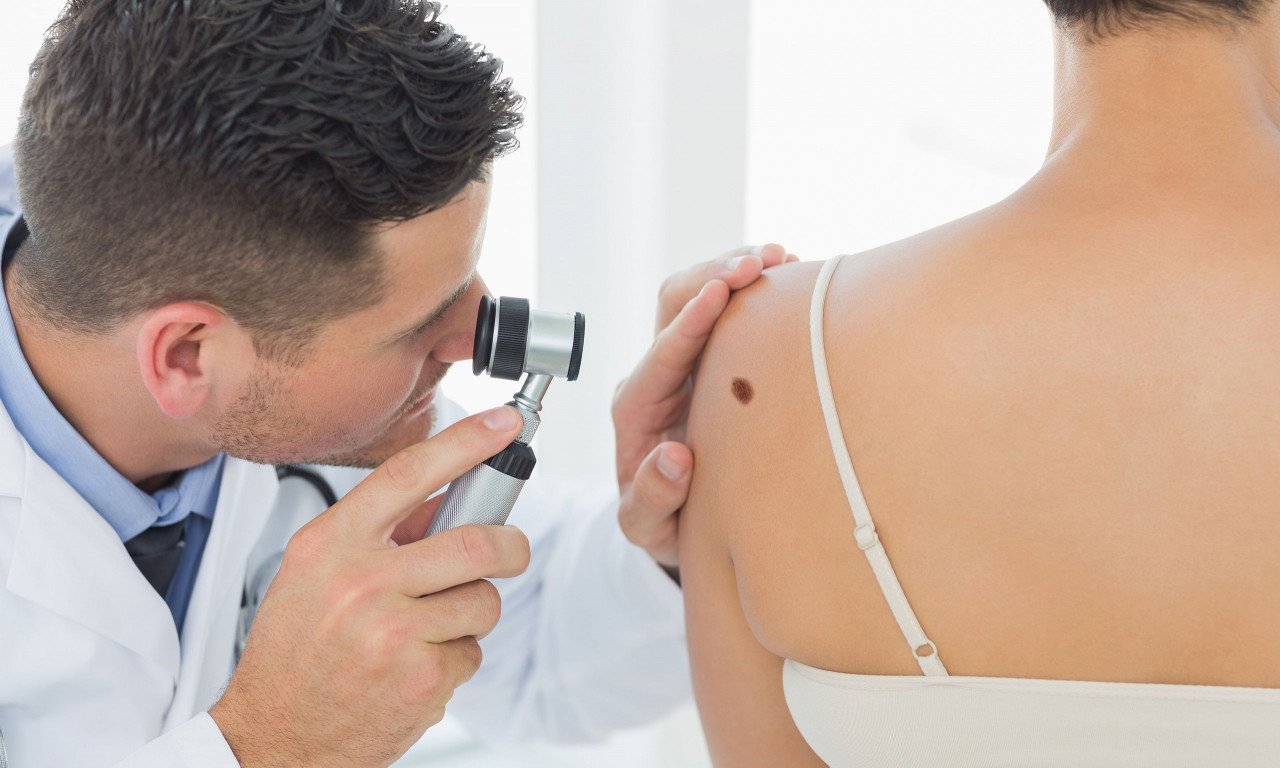 You are currently viewing Επιθετικό μελάνωμα: Ο συνδυασμός φαρμάκων που εξόντωσε τα καρκινικά κύτταρα