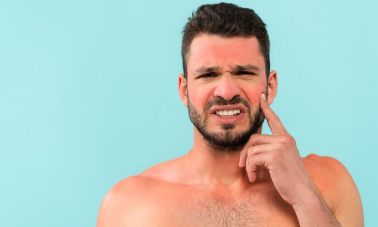 Read more about the article Ηλιακό έγκαυμα: Ποια είναι η καλύτερη θεραπεία σύμφωνα με δερματολόγους;