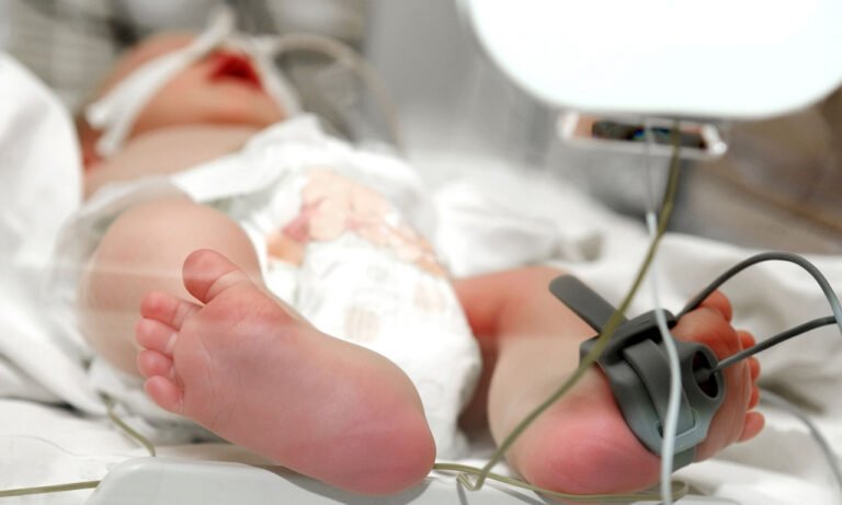 Read more about the article Η τραγική γενετική νόσος που προκαλεί σκληρά «λέπια» στα μωρά