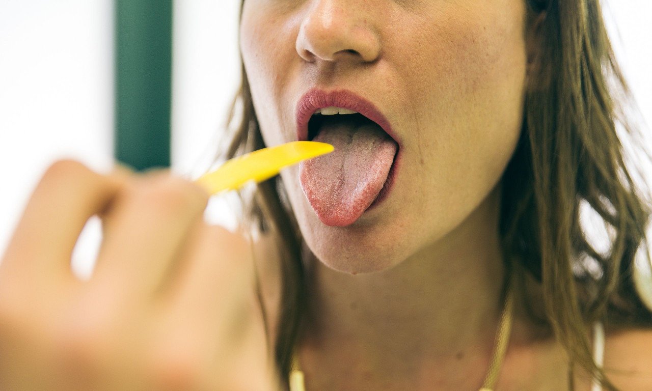 You are currently viewing Στρεπτόκοκκος: Φωτογραφίες συμπτωμάτων – Τι πρέπει να ξέρετε