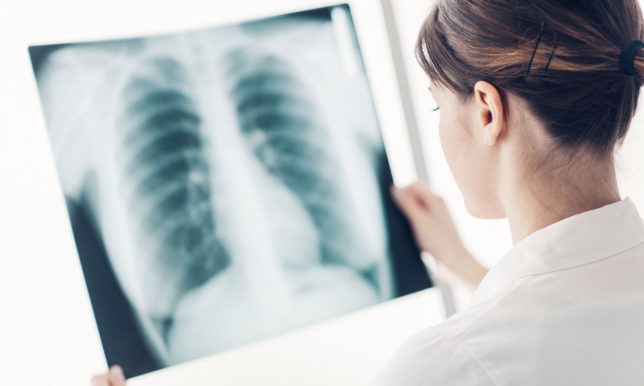 You are currently viewing Πνευμονίτιδα υπερευαισθησίας: Οι παράγοντες κινδύνου και το προσδόκιμο ζωής