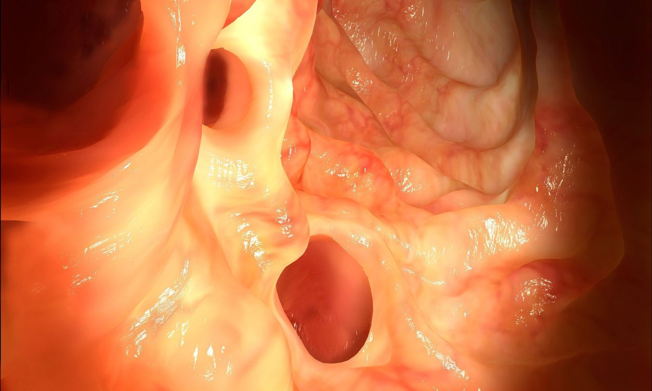 You are currently viewing 5 παράγοντες που αυξάνουν τον κίνδυνο εκκολπωματίτιδας