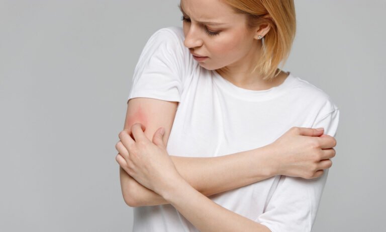 Read more about the article Δερματίτιδα: Όλοι οι τύποι και πώς φαίνεται ο καθένας στο δέρμα
