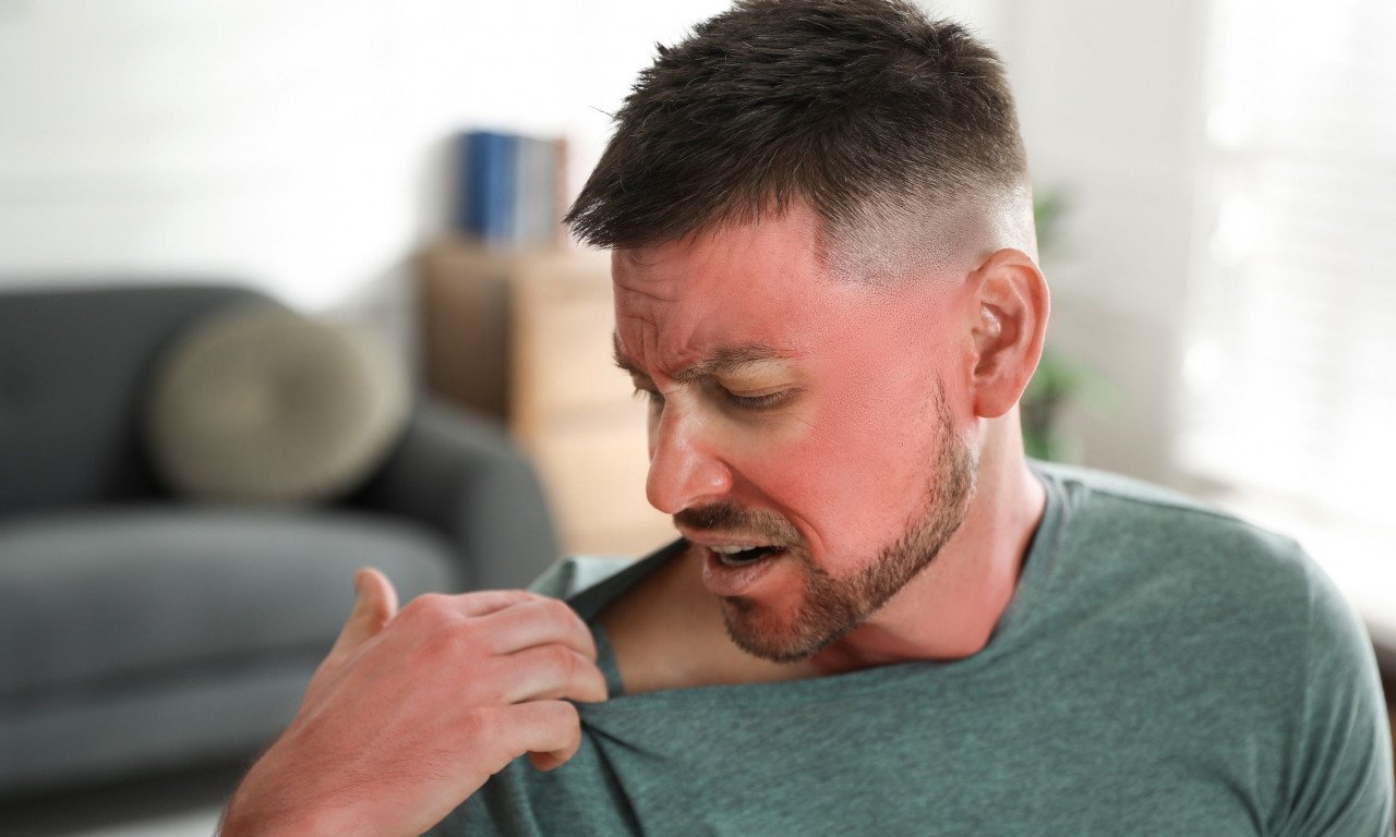 You are currently viewing Τι είναι η ηλιακή δηλητηρίαση και πώς μπορείτε να την αναγνωρίσετε;