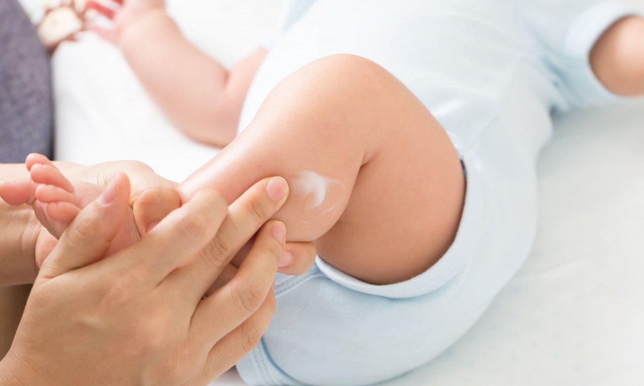 You are currently viewing Ατοπική δερματίτιδα: Μειώνουν οι μαλακτικές κρέμες τον κίνδυνο αλλεργιών στα βρέφη;
