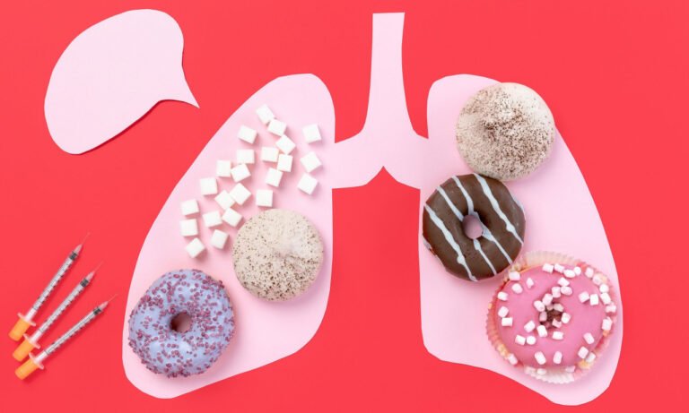 Read more about the article Οι τροφές που αυξάνουν τον κίνδυνο για καρκίνο του πνεύμονα (μελέτη)