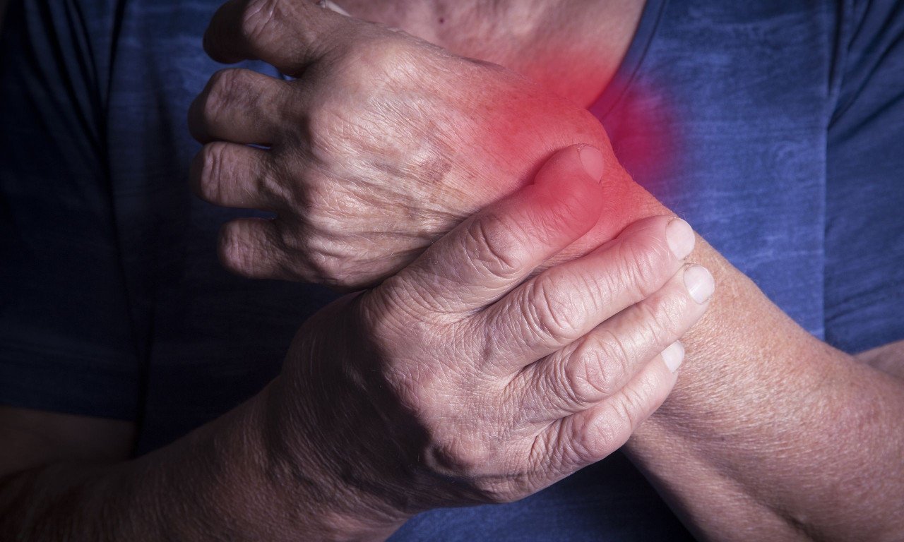 You are currently viewing Υπάρχει θεραπεία για τη ρευματοειδή αρθρίτιδα;