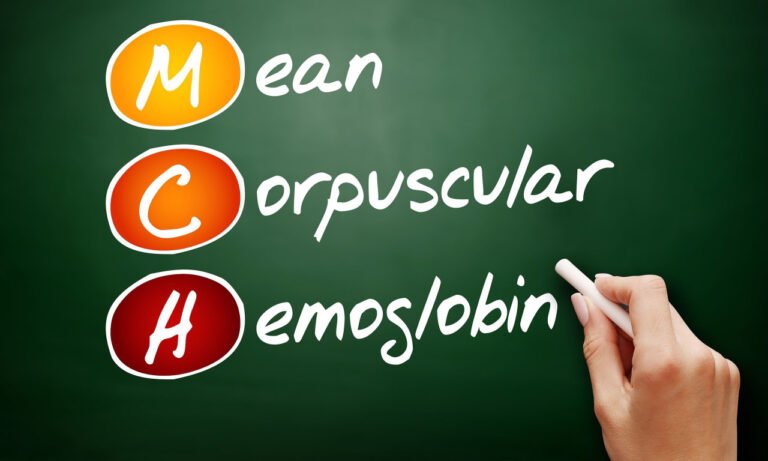 Read more about the article MCH: Τι σημαίνει η Μέση Περιεκτικότητα Αιμοσφαιρίνης στις αιματολογικές εξετάσεις