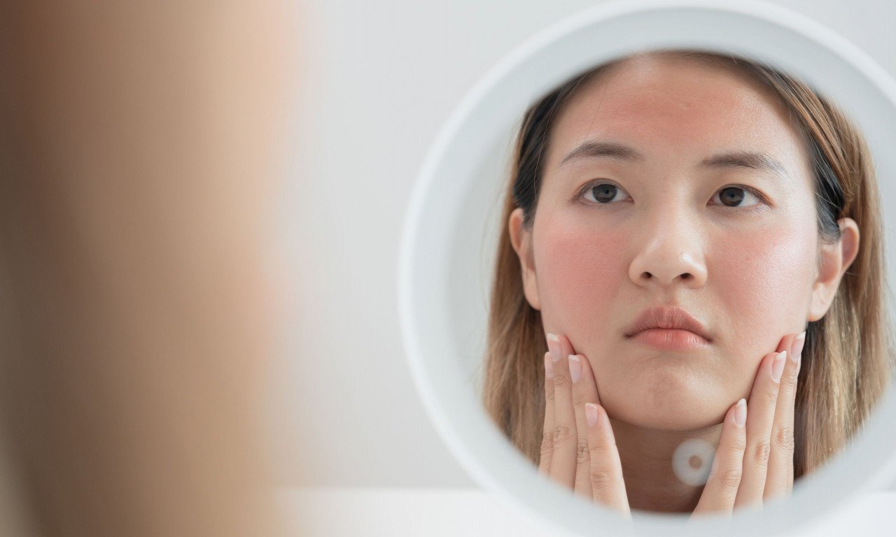 You are currently viewing Εξανθήματα στο σώμα: Τι θα προσέξετε αν κάτι σοβαρό συμβαίνει