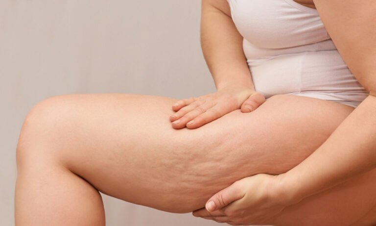 Read more about the article Λιποίδημα: Τι είναι και πώς αντιμετωπίζεται