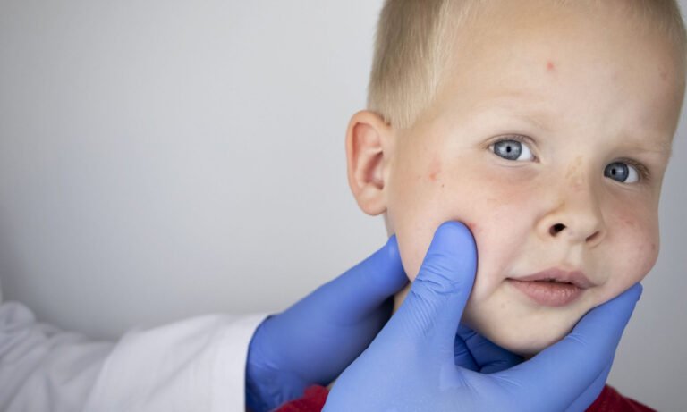 Read more about the article Ποια νόσος που δεν έχει θεραπεία ήταν σε ύφεση, αλλά εξαπλώνεται ξανά παγκοσμίως