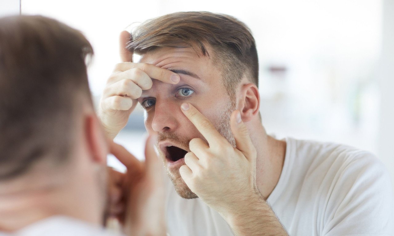 You are currently viewing Γιατί ξυπνάτε με κατακόκκινα μάτια; Πότε είναι αιτία ανησυχίας