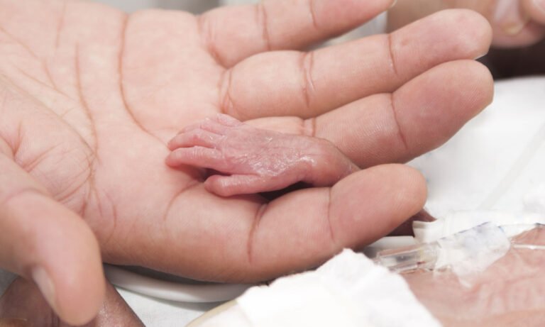 Read more about the article Πρόωρος τοκετός και κακή ανάπτυξη καταδικάζουν 1 στα 5 παιδιά κάτω των 5 ετών – Έρευνα