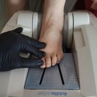 Μέτρηση Οστικής Πυκνότητας στο σπίτι