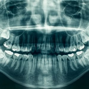 panoramic-dental-x-ray-2026-01-07-23-09-36-utc (1)